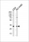 H2AFY2 Antibody (Center)